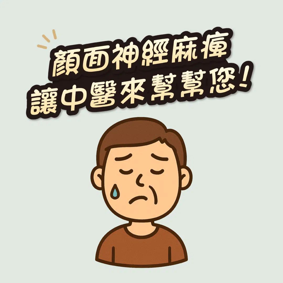 顏面神經麻痺